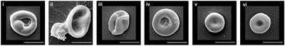 Reticulocyte Maturation and Variant Red Blood Cells
